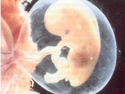 Aborto, feto di nove settimane testimone in aula a favore della vita