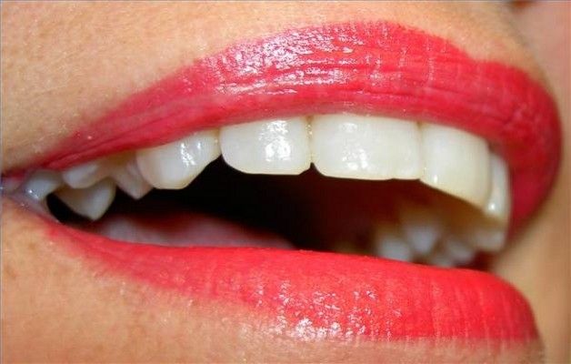 denti bianchi naturalmente