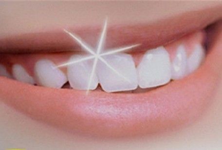 Denti più bianchi col laser