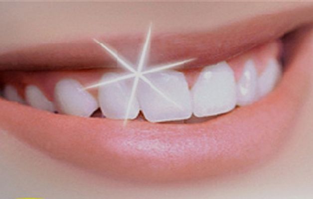 Denti più bianchi col laser
