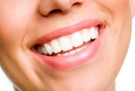 Come sbiancare i denti, i metodi fai da te per un sorriso perfetto
