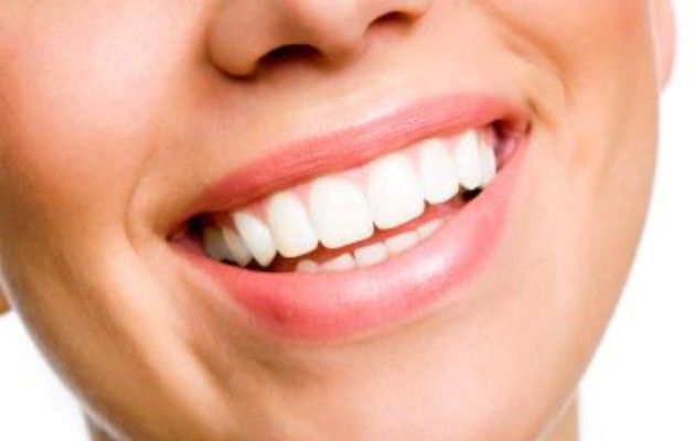 Come sbiancare i denti, i metodi fai da te per un sorriso perfetto