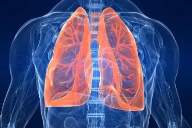 Embolia polmonare, cause, diagnosi, linee guida e terapia