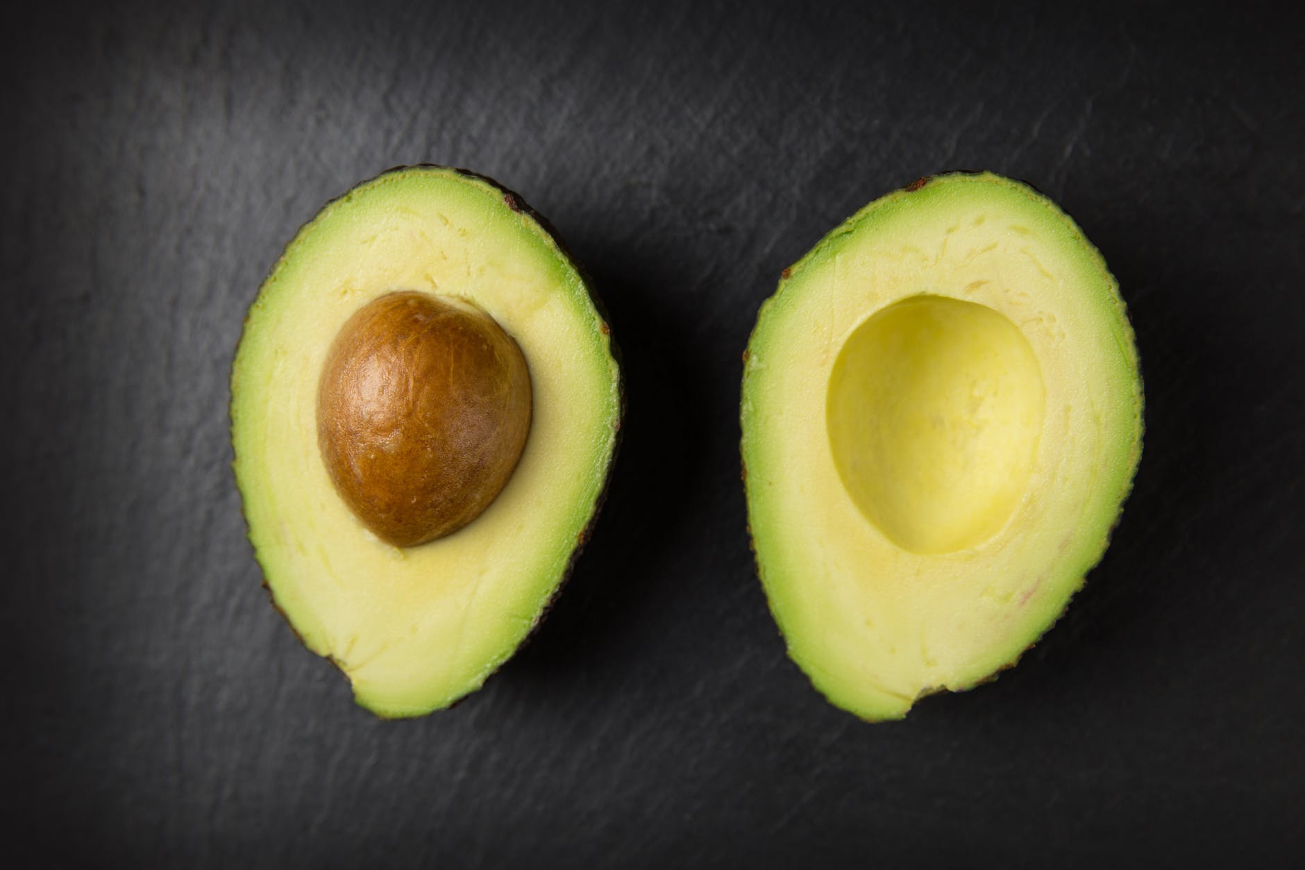 alimenti per combattere colesterolo avocado